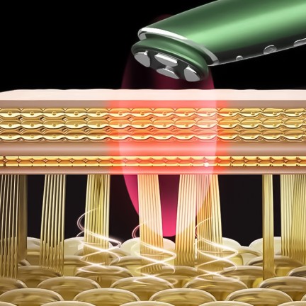 Vacuum radio frequency eye tightening beauty device